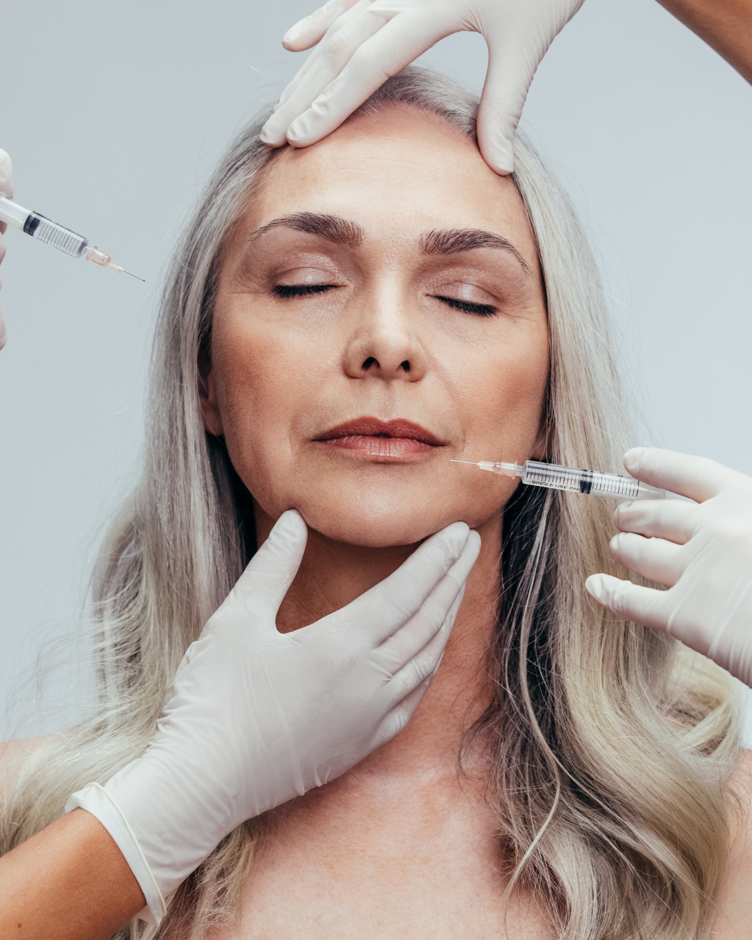 Jawline (Çene Dolgusu) Nedir?