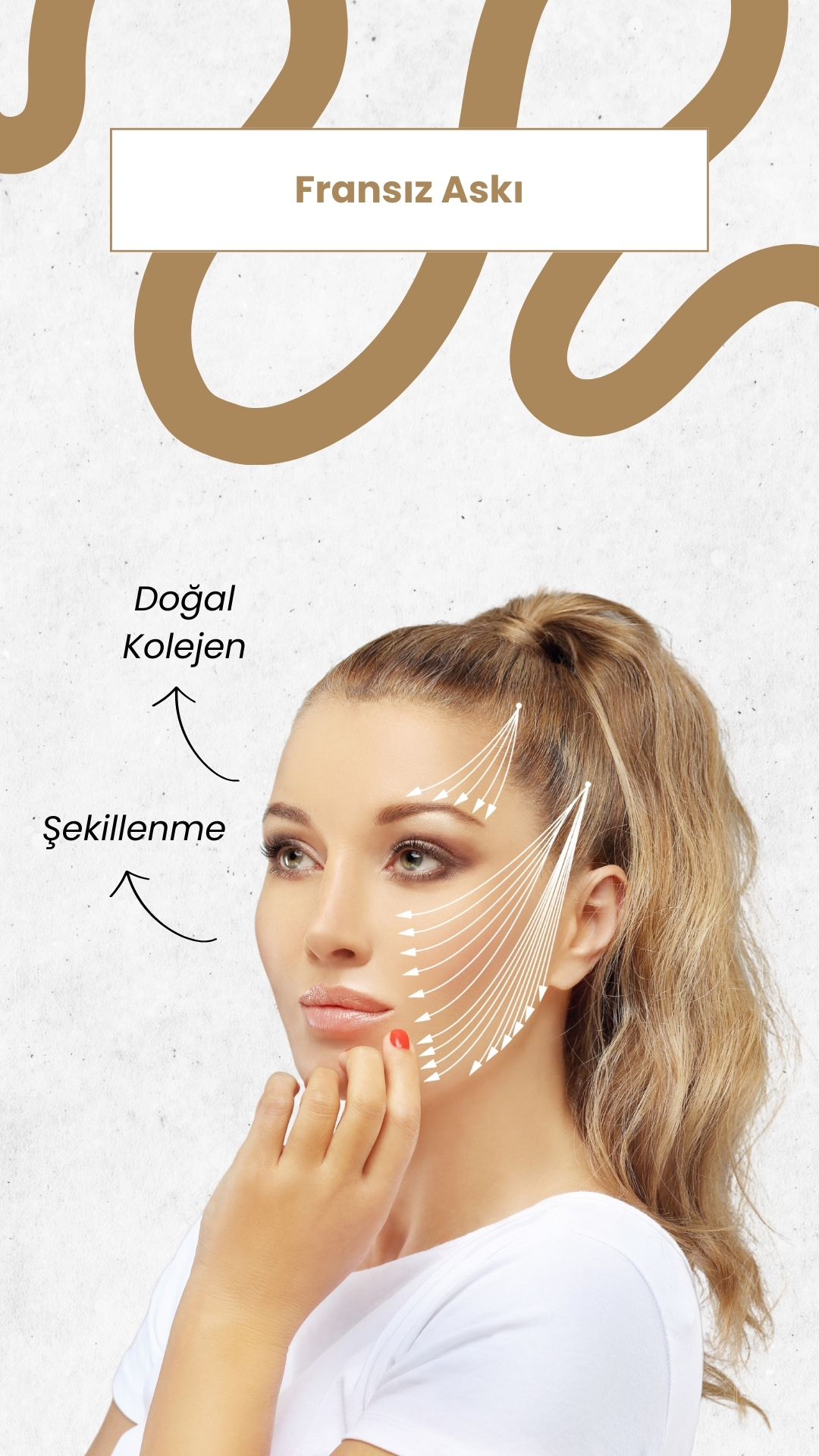 Fransız Askı